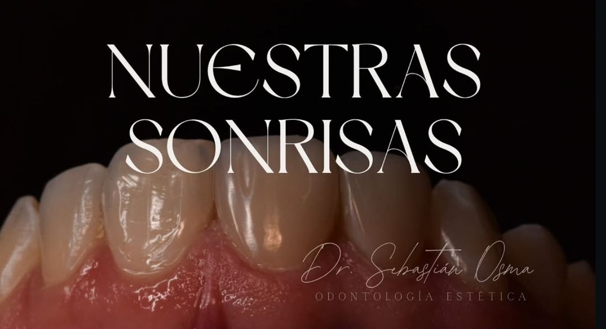 Trabajo de odontología DentArt Family en el norte de Bogotá